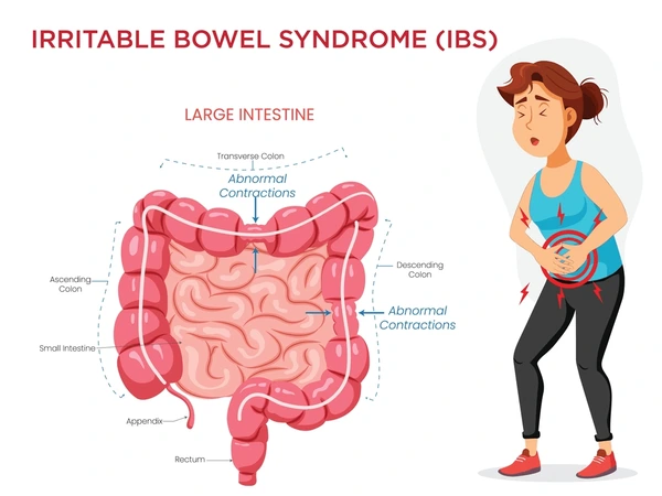 irritable-bowel-syndrome